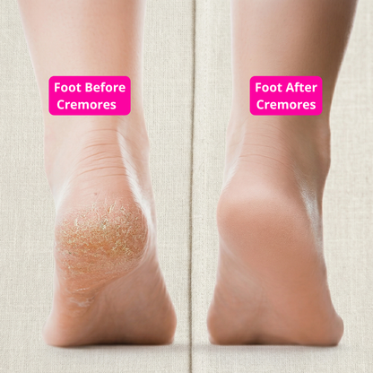 Cremores Silk Pedicure